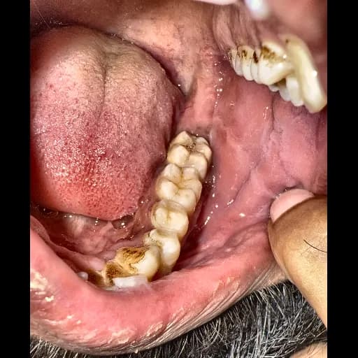 Cliché intra-oral original
