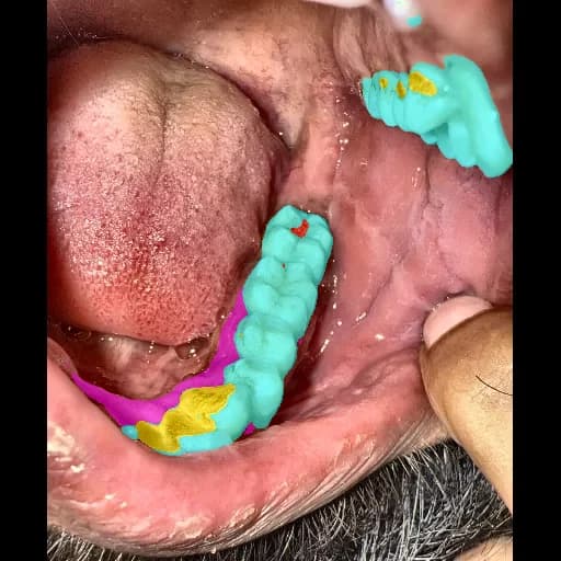 Segmentation IA MouthCare