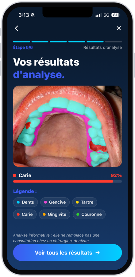 App, résultats de l'analyse
